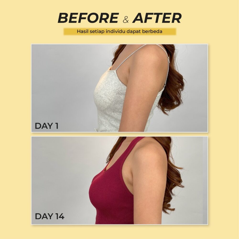 Paket Usaha Reseller Smart Breast - 10 Pcs Luxury Oil - Gambar 3
