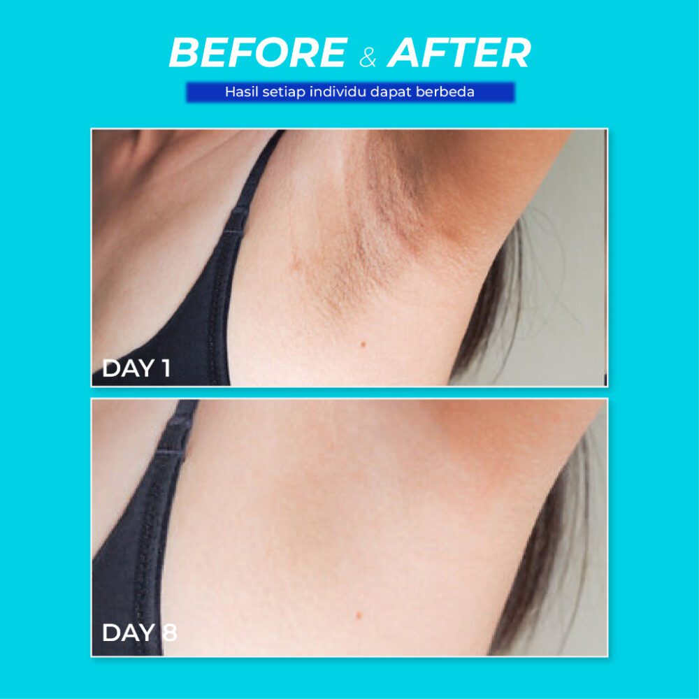 Smart Breast Keti Line Glow Brightening Cream | Pemutih Ketiak, Selangkangan, Siku, Lutut dan Leher - Gambar 6