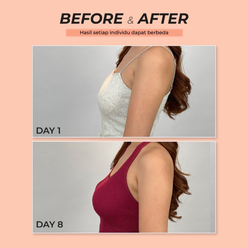 Smart Breast Cream Pembesar & Pengencang Payudara Terbaik - Smart Breast Luxury Cream - Gambar 6