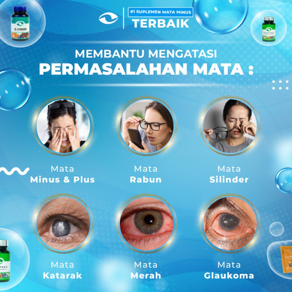 S-VISION (OBAT MATA MINUS, PLUS, SILINDER) - Paket Reseller 10 Botol 30 Kapsul
