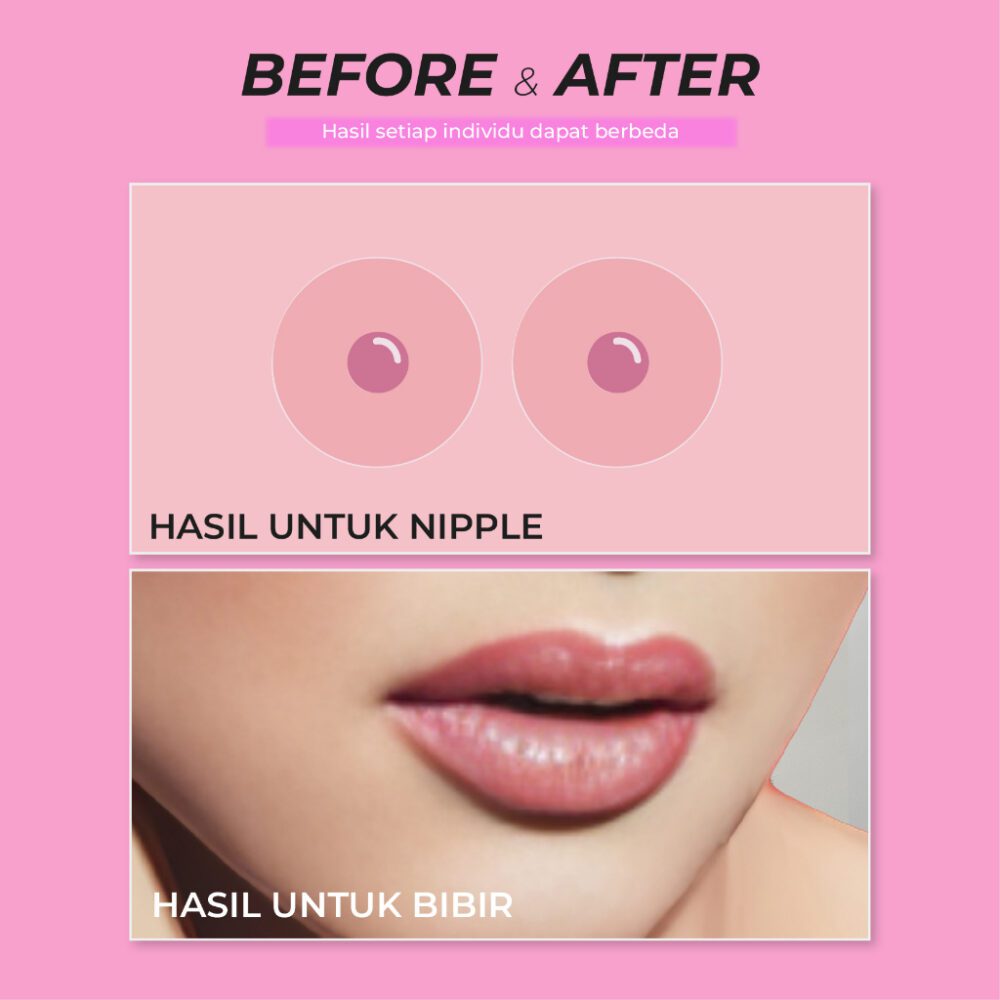 Smart Breast Lip & Nipple Care ( Pencerah Bibir dan Puting Terbaik dan Alami ) PROMO - Gambar 6
