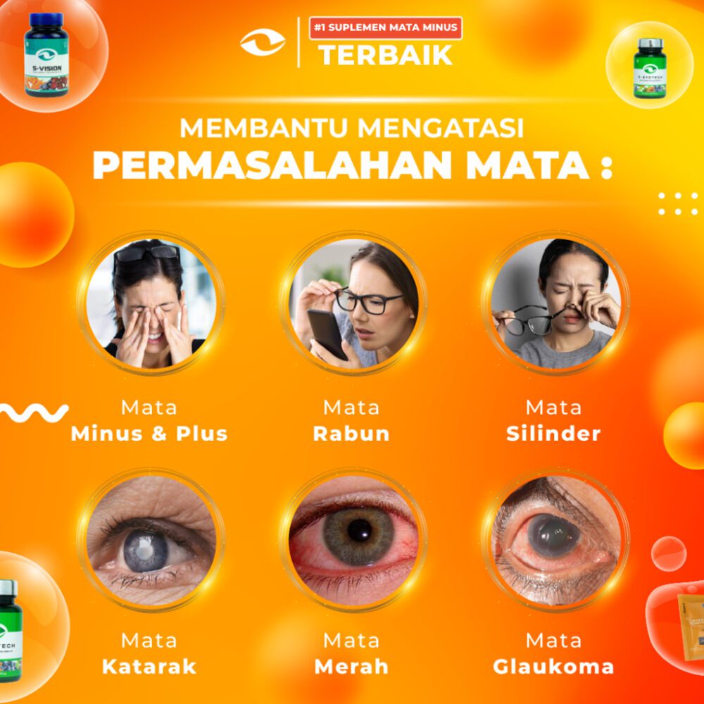 SMART VISION Suplemen Kesehatan Mata Minus, Plus, Silinder Terbaik - Paket Reseller 10 BOX SMART VISION