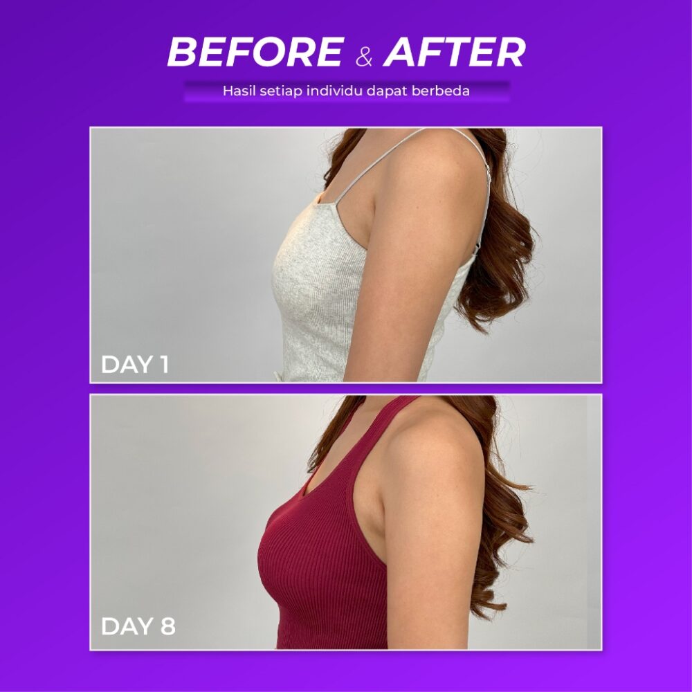 Paket Usaha Reseller Smart Breast - 10 Box Lady Boss - Gambar 3