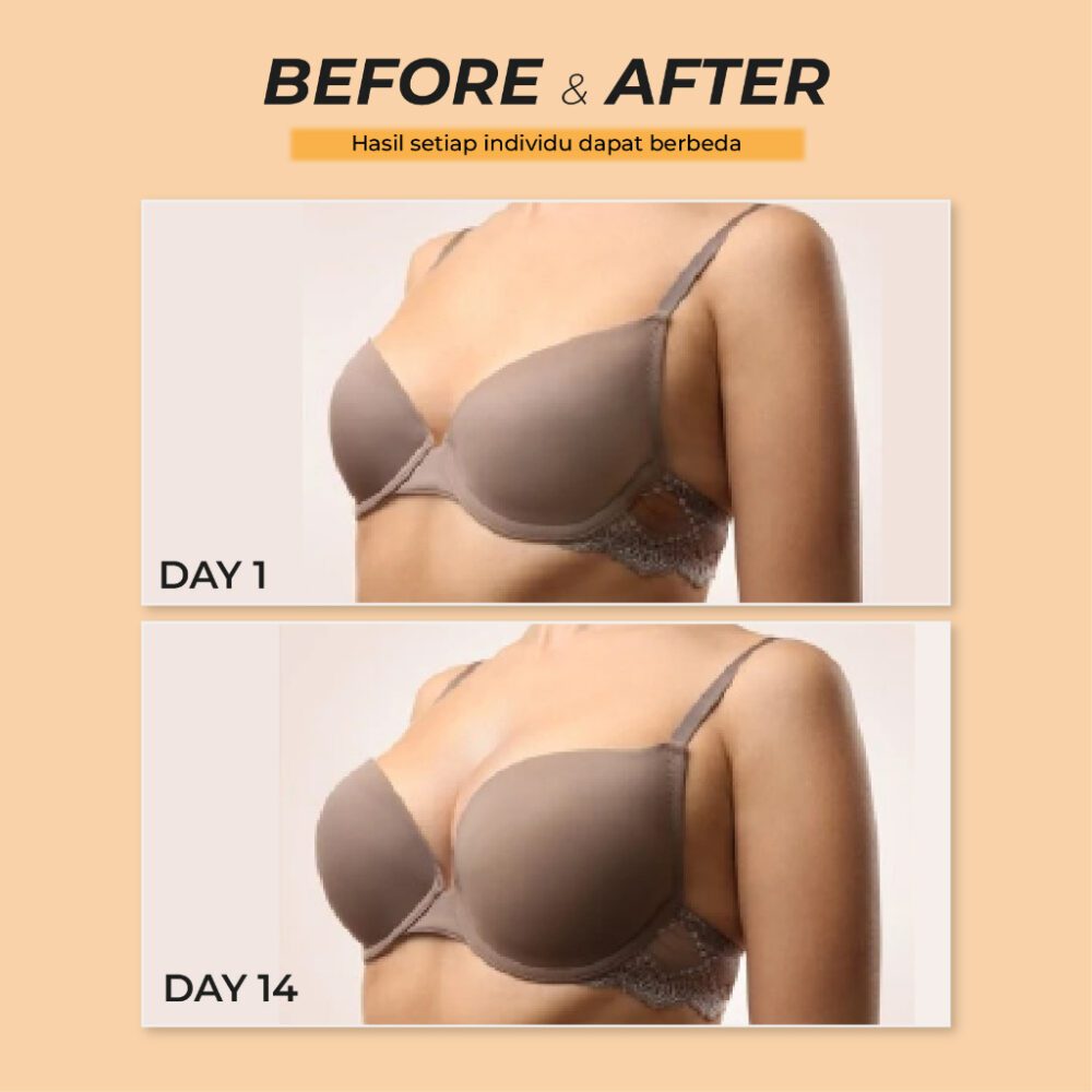 Serum Pembesar & Pengencang Payudara Terbaik - Smart Breast Luxury Serum PROMO - Gambar 6