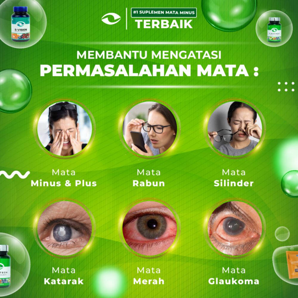 SMART VISION Suplemen Mata Minus, Plus, & Silinder Terbaik - S Eyetech 60 Kapsul